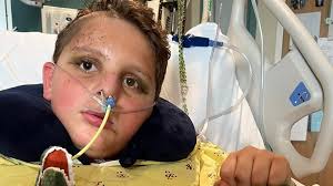 Wichita boy hit by car is awake, could transfer rehabilitation hospital  soon