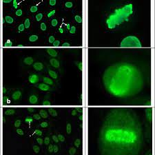 Differentiation Of Ana Patterns On Hep 2 Cells That Share A Diffuse Download Scientific Diagram