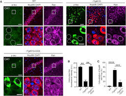 Tau Protein Disrupts Nucleocytoplasmic Transport in Alzheimer's Disease