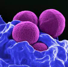 We did not find results for: Gefahrlicher Superkeim Klebsiella Pneumoniae 4 Mrgn Auf Intensivstation In Frankfurt Welt
