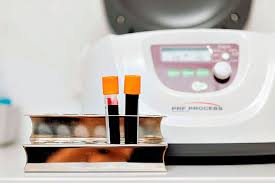 Image result for Fatigue Diagnostic Testing