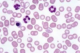 Lead Poisoning In Animals Toxicology Msd Veterinary Manual