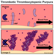 Purpura does not tend to appear and become itchy or irritated either. Thrombotic Thrombocytopenic Purpura Ttp Hematology Medbullets Step 1