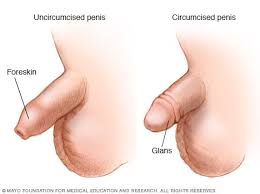 Image result for circumcision shield