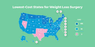 Pin On Weight Loss Surgery Insurance