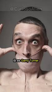 El hombre con la piel más elástica del mundo #personasunicas #mundocurioso  #sabiasquee #pielelastica #recordguiness #nosabias #increibleperocierto