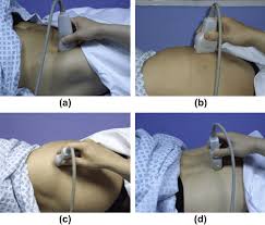 Image result for Hip Exam