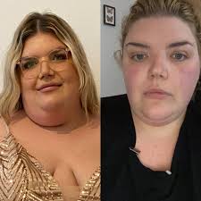 Is weight loss of 26 pounds in one week too fast after vsg surgery?