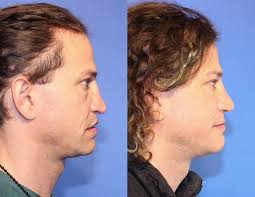 Accident Reconstruction Experts South Africa