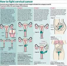 Pin On Mesothelioma