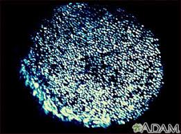 Spread soft, diffused light to create a warm, cozy atmosphere. Wood S Lamp Examination Information Mount Sinai New York