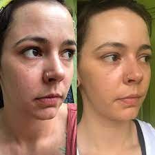31 Amazing Skin Care Products With Over 1 000 Reviews Vitamins For Clear Skin Uneven Skin Vitamins For Skin