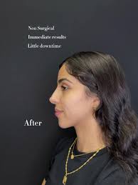 Anna Theodoridi Nose