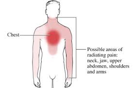 Image result for Angina Pectoris