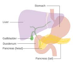 Although pancreatic cancer accounts for only about 3% of all cancers in the united states, it is the fourth leading cause of cancer deaths in both men pancreatic cancers can arise from the exocrine and endocrine portions of the pancreas, but 93% of them develop from the exocrine portion, including. Pancreatic Cancer Wikipedia