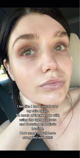 Lauren Oconnell Survivor Body Before and After