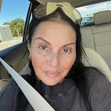 5 months post op gastric bypass! Down 219.2lbs