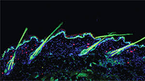 This is an area of my scalp that hadn't seen any hair growth since i was a teenager. New Hair Growth Mechanism Discovered Uc San Francisco