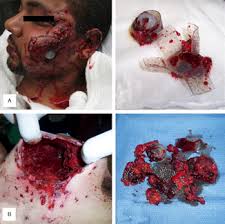 The effective range or kill range is not the same thing as the actual range of the round. Ballistics Chapter 10 Color Atlas Of Emergency Trauma