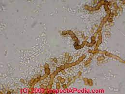 A general mold count of 320 spores per cubic meter is pretty low; Green White Or Black Mold Under The Microscope Micro Photographs Of Mold A Chapter Of What Does Mold Look Like Mold Detection Mold Identification Mold Recognition Homeowners Guide To Mold