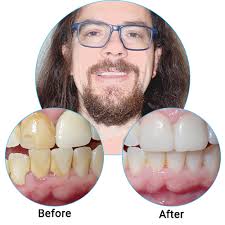 Cosmetic Dentistry