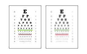 Image result for Eye Examination