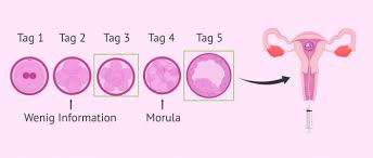 Die einnistung beginnt zwischen dem fünften und sechsten tag nach der befruchtung und ist ungefähr am 12. Der Embryotransfer Anzahl Der Embryonen Und Ablauf