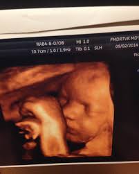 How are you already 10 years old today, you wonderful, beautiful, spunky,  funny, kind, smart amazing little force of a creature? The day you were  born was the best day of my