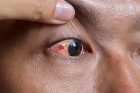 Image result for Sclera