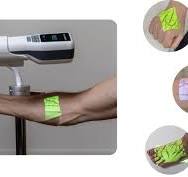 Hellovein ® | Lite 2.0 Vein Finder with Mobile Trolley