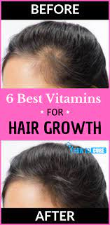6 Best Vitamins For Your Beautiful Hair Howtocure Vitamins For Hair Growth Hair Vitamins Treat Hair Loss