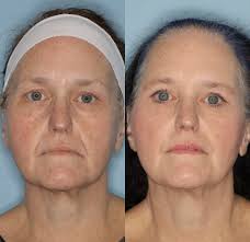 Earlier this week we were fortunate to celebrate the establishment of the  Erika Bridgeforth Hartman DDS and Corey Louis Hartman MD Endowed Faculty  Scholar in Resident Education at the UAB Heersink School