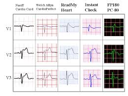 1 Lead To 12 Lead And Exercise Ecg