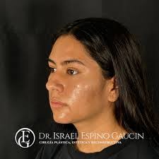 Israel Espino's Instagram, Twitter & Facebook