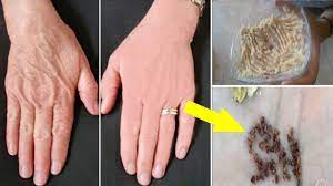 بذور هذه الفاكهة لعلاج تجاعيد اليدين طبيعيا اوقف العالم مندهشا Beauty Skin Care Routine Beauty Care Beauty Skin Care