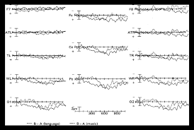 In music and music theory, phrase and phrasing are concepts and practices related to grouping the term, like sentence, verse etc., has been adopted into the vocabulary of music from linguistic. Difference Waves For Condition B A In Language And Music The Solid Download Scientific Diagram