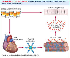 Andrew R Houghton On Twitter Holiday Heart Syndrome How Does Binge Drinking Alcohol Promote The Onset Of Atrial Fibrillation Https T Co 8hawwcrskf Https T Co Topjoo7rhg