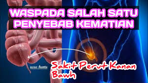 Selain terasa sakit penderitanya juga akan. Sakit Perut Bagian Kanan Bawah Hilang Timbul Youtube