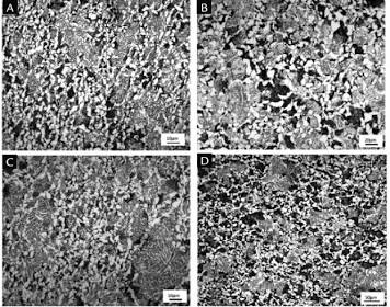 Ferritic-pearlitic microstructure of forged axle steel, AI generated