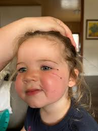 Magpies attacking cyclists near Somerset Dam