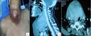 The Pan African Medical Journal Image Quiz