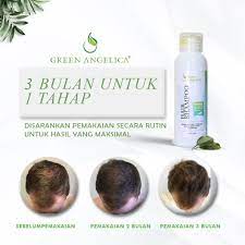 Shampo Herbal Penumbuh Rambut Rontok Dan Anti Ketombe Tercepat Green Angelica Hair Shampoo Shopee Indonesia Rambut Rontok Rambut Alami Ketombe