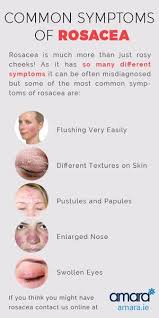 Do I Have Rosacea Rosacea Facts Advice Rosacea Skin Care Sensitive Skin Treatment Sensitive Skin Care