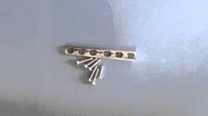Since many people have titanium inside their body as medical implants because the magnetic field created by titanium is too weak to be detectable by the metal detector. Does Titanium Go Off In Metal Detectors Ceramics