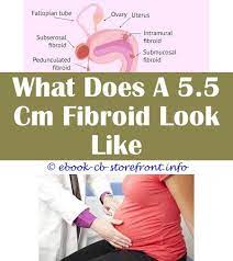 A ketogenic diet plan can help you regain your health! 4 Appreciate Simple Ideas Is Tiredness A Symptom Of Fibroids Ketogenic Diet And Fibroids Fibroid Ultrasound How Are Periods With Fibroids Uterine Fibroids How
