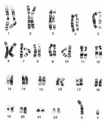 Females have two xs and males have one x and one y. Teaching Anatomy Chromosome And Chromosomal Disorders Chromosomal Disorders Dna Research Chromosome