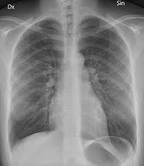 Dental filling costs without insurance can vary. X Ray Tests How They Work What They Show How To Get An X Ray Patient