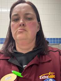 Anyone else experience this rash with any autoimmune disease they have?  This is the third time it's popped up for me.