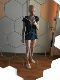 Arten chemotherapie bei brustkrebs, wirkstoffe, durchführung, fasten, nebenwirkungen, polyneuropathie, berichte von patientinnen jahrhunderts entwickelt, eine medikamentöse therapie, die eine vermehrte zellteilung hemmen kann. Diagnose Brustkrebs Chemo Ist Wie 3 Tage Dauer Kater Brigitte De