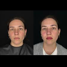 Dermacare of Hampton Roads